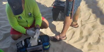 Han atendido a bañistas que fueron  “picados” por “aguamala” o Medusas