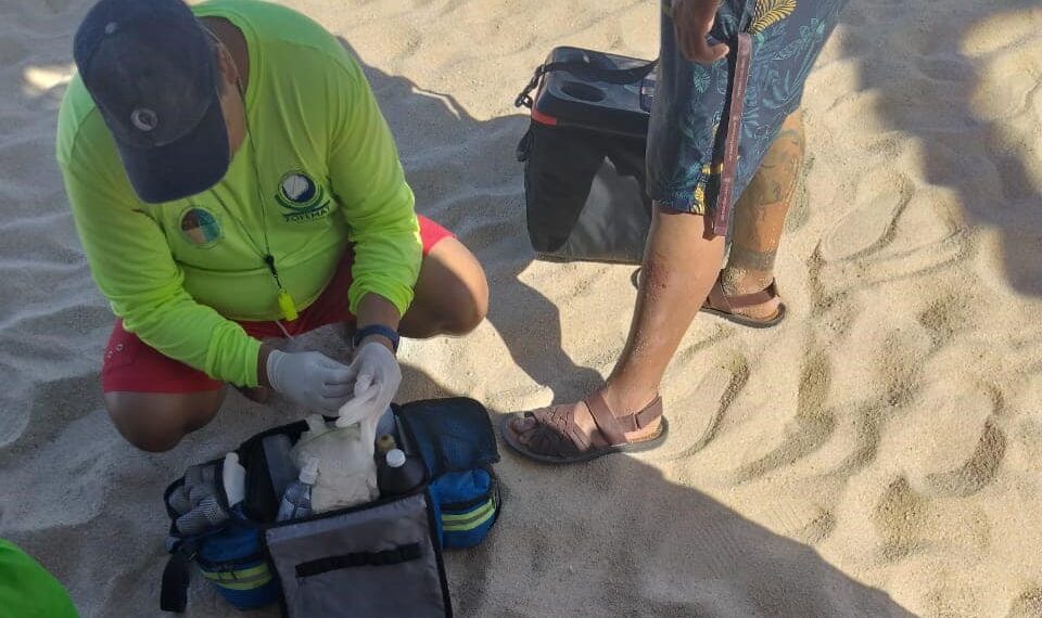 Han atendido a bañistas que fueron  “picados” por “aguamala” o Medusas